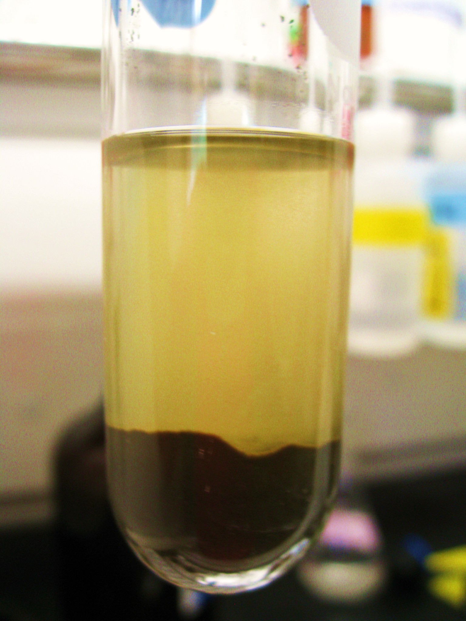 Lipid Extraction